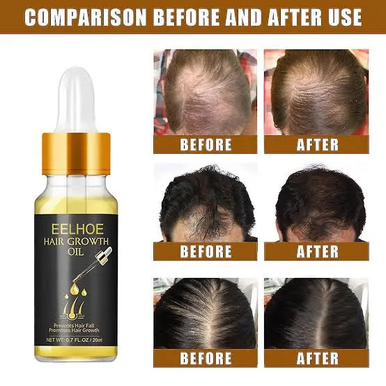 EELHOE Hair Growth Serum for Men Women